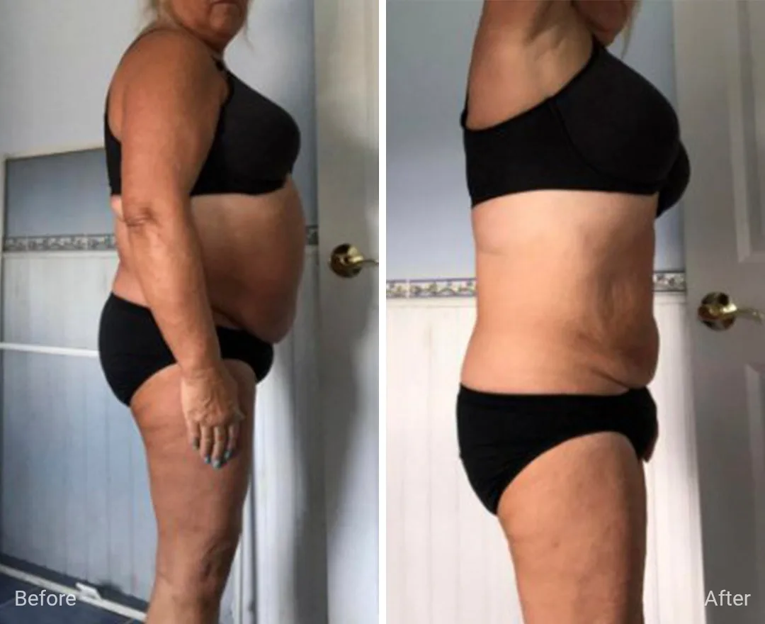 Client before and after — result 1