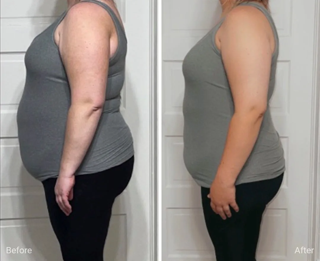 Client before and after — result 2
