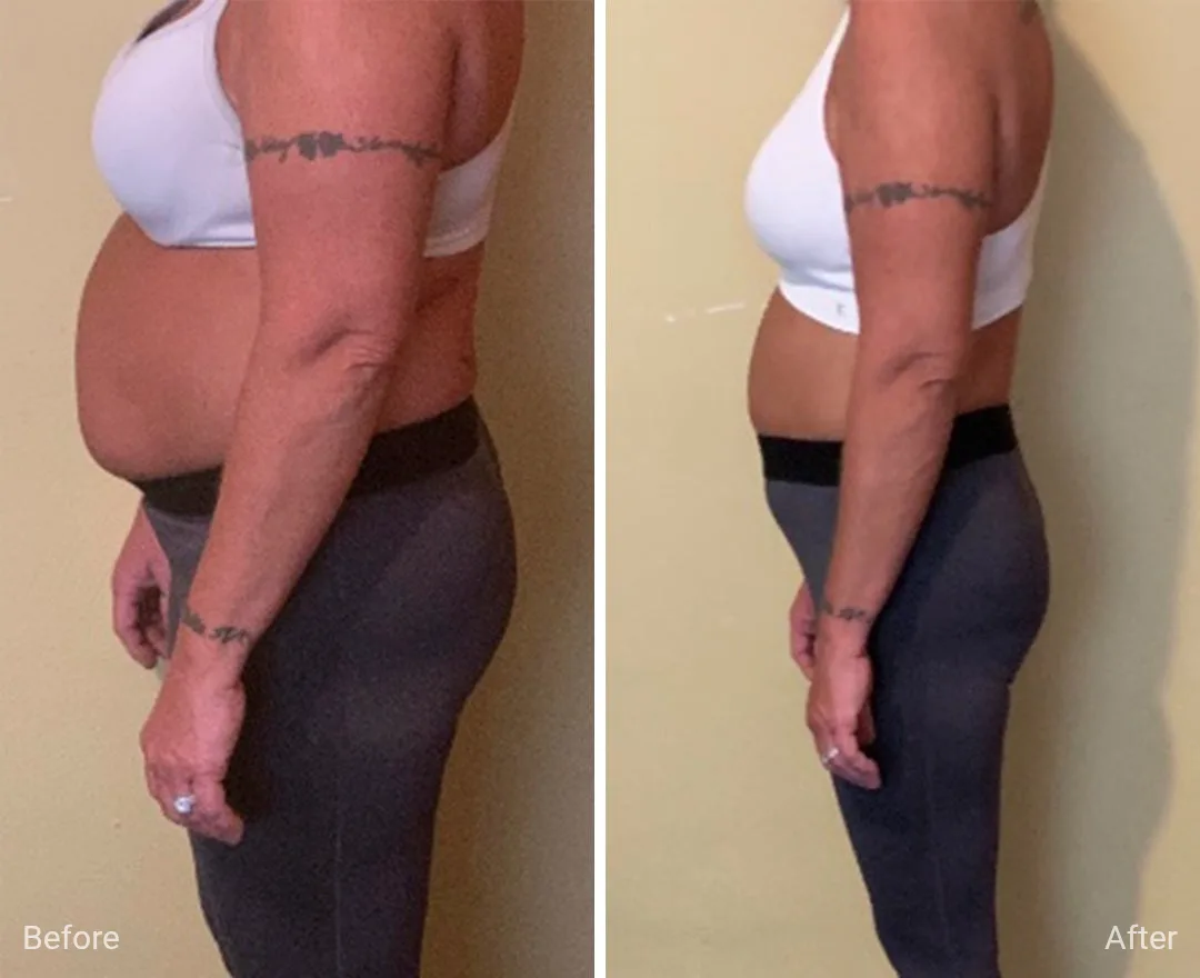 Client before and after — result 3