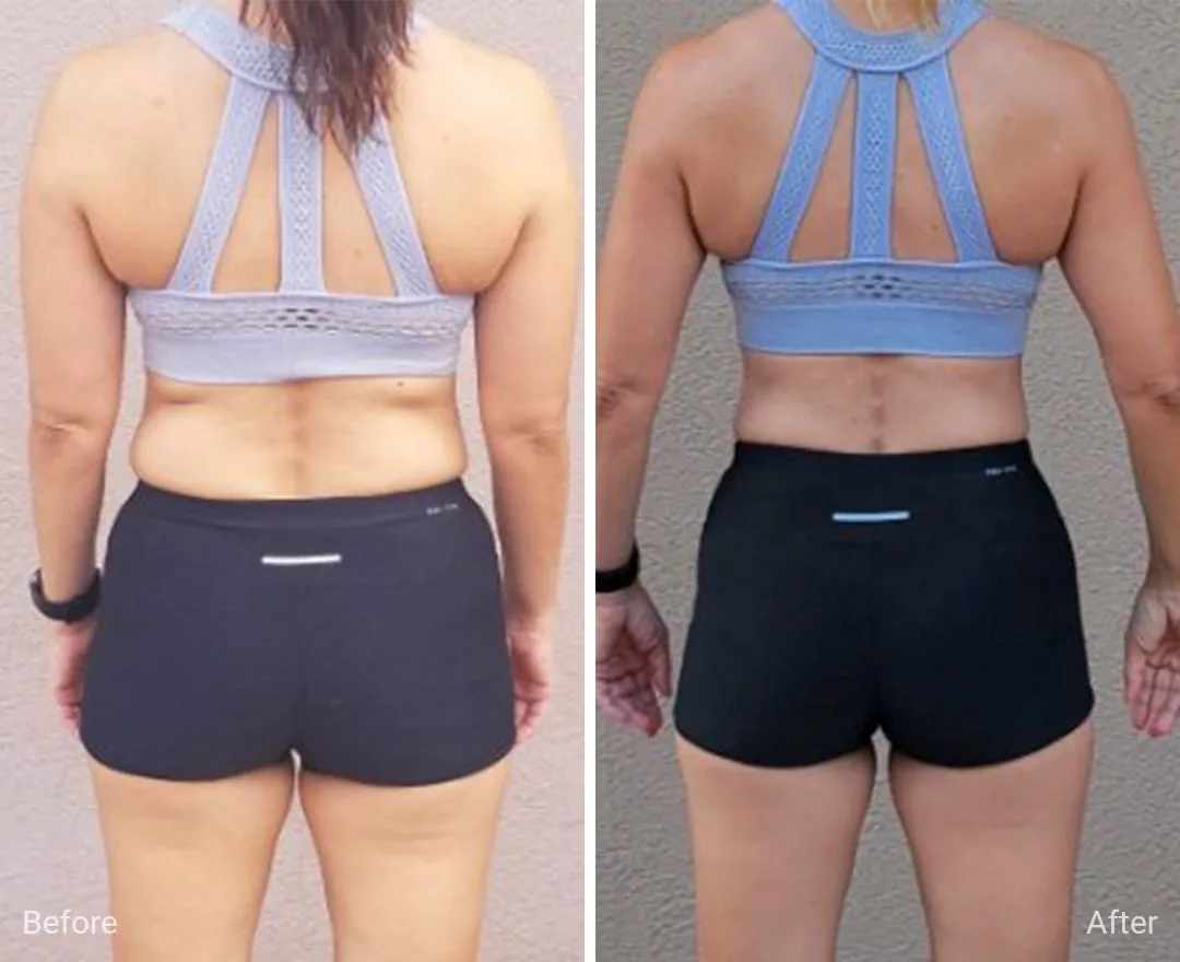Client before and after — result 4